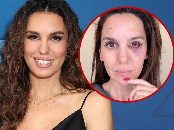 Christy Carlson Romano Says She Was Shot In Face Whereas Taking pictures Clay Pigeons