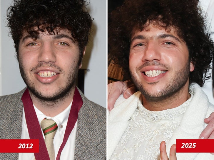 Benny Blanco — Good Genes or Good Docs?!