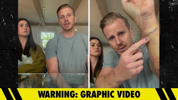 ‘Bachelor’ Sean Lowe Attacked 3 Occasions by Rescue Canine, ‘Blood All over the place’