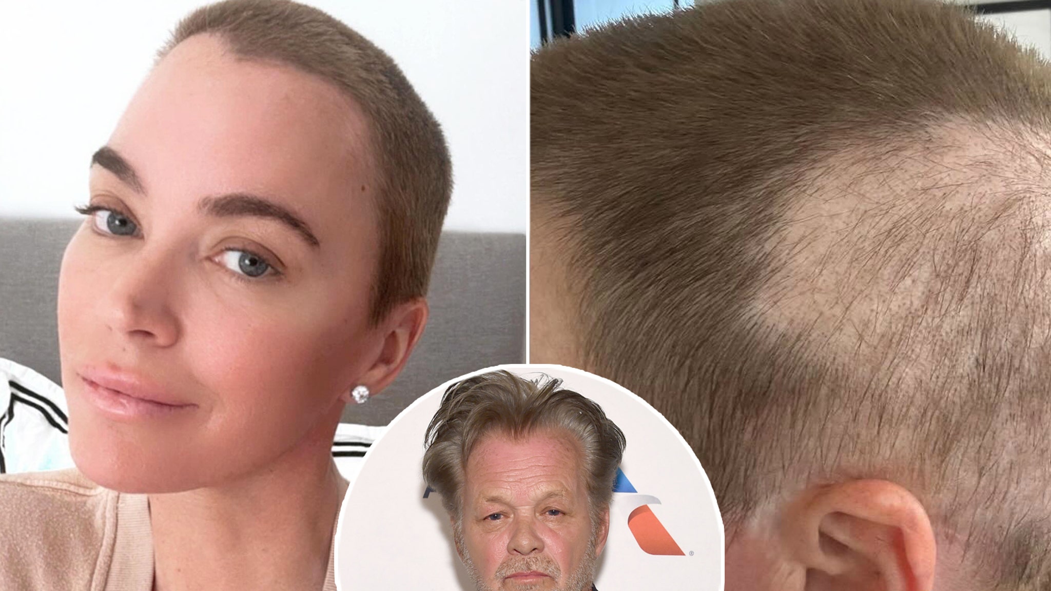 Teddi Mellencamp Feels Alone Throughout Most cancers Journey