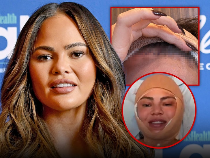 Chrissy Teigen Addresses Bandaged Face After Surgical procedure