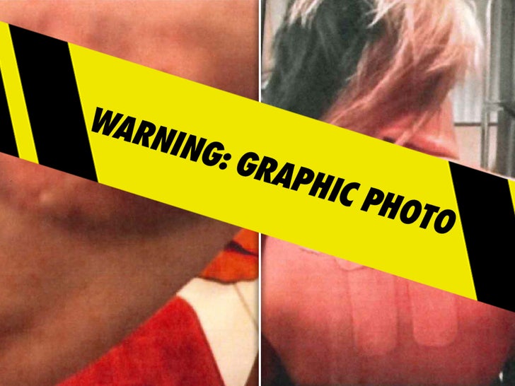 Bryana Bongolan’s Alleged Harm Pictures From Diddy Balcony Incident Filed As Proof