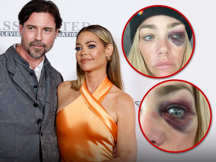 Denise Richards Accuses Estranged Husband of Home Violence, Threatening Her Life