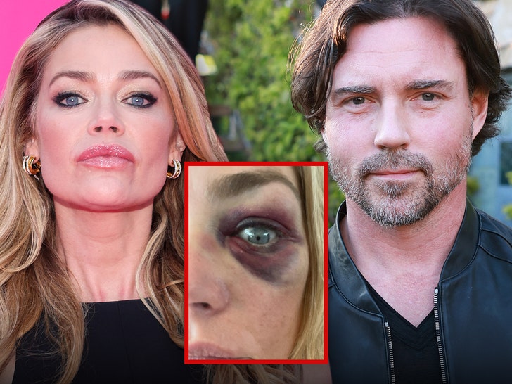 Denise Richards’ Estranged Husband Denies Abuse Allegations